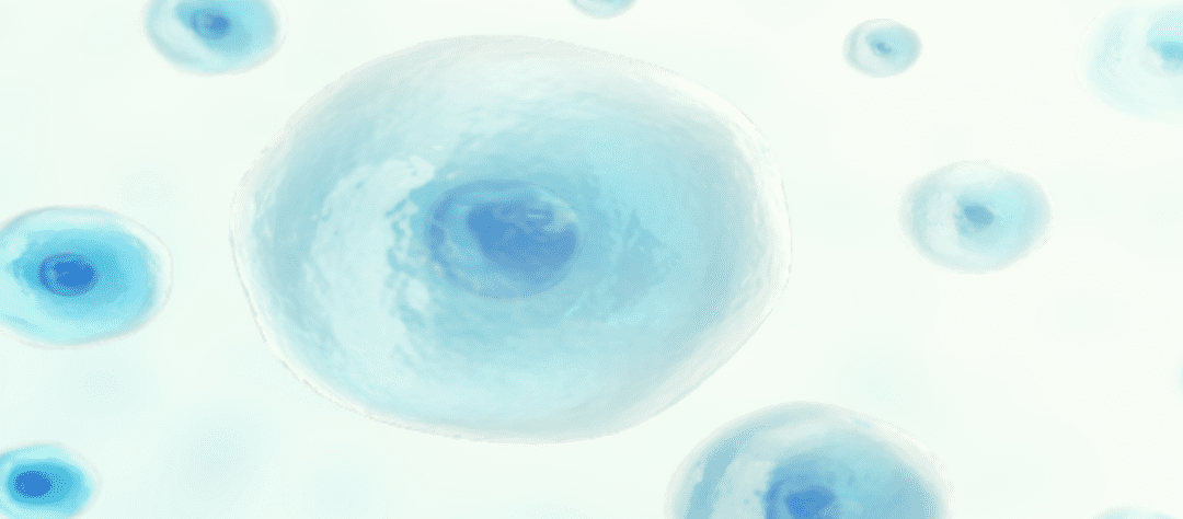 A Look into Stem Cell Therapy for Lupus