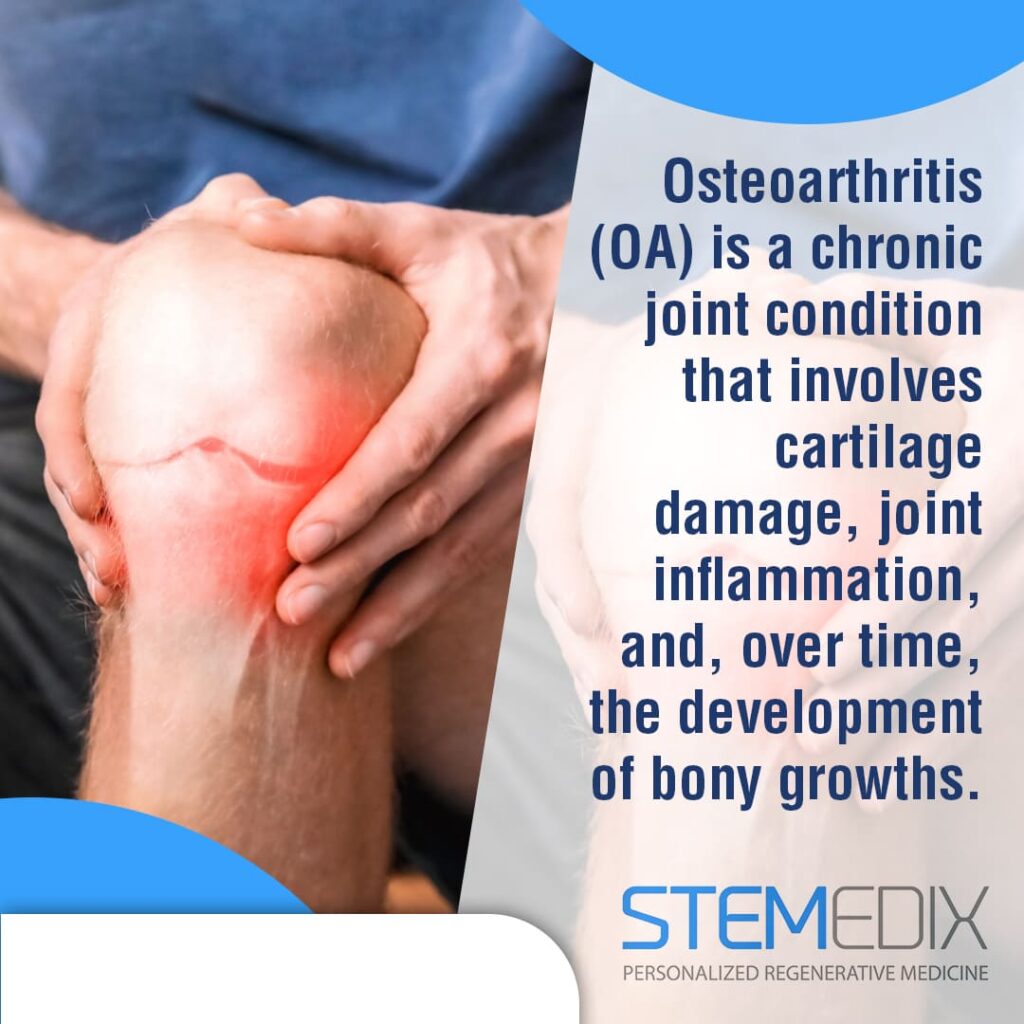 Osteoarthritis vs. aging with regenerative medicine benefits