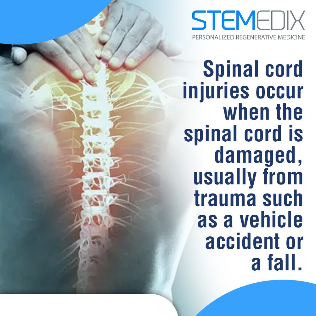 Role of Regenerative Medicine in Recovery