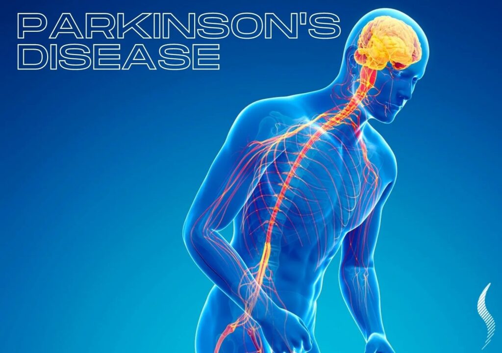 Medical illustration of human body highlighting brain and nervous system affected by Parkinson’s disease